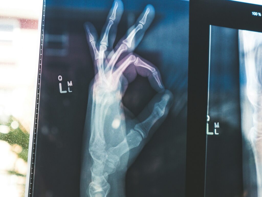 „Google“ atidaryti „Medgemma AI“ modeliai galėtų pakeisti sveikatos priežiūrą